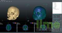Real3D VolViCon