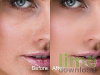 SkinFiner