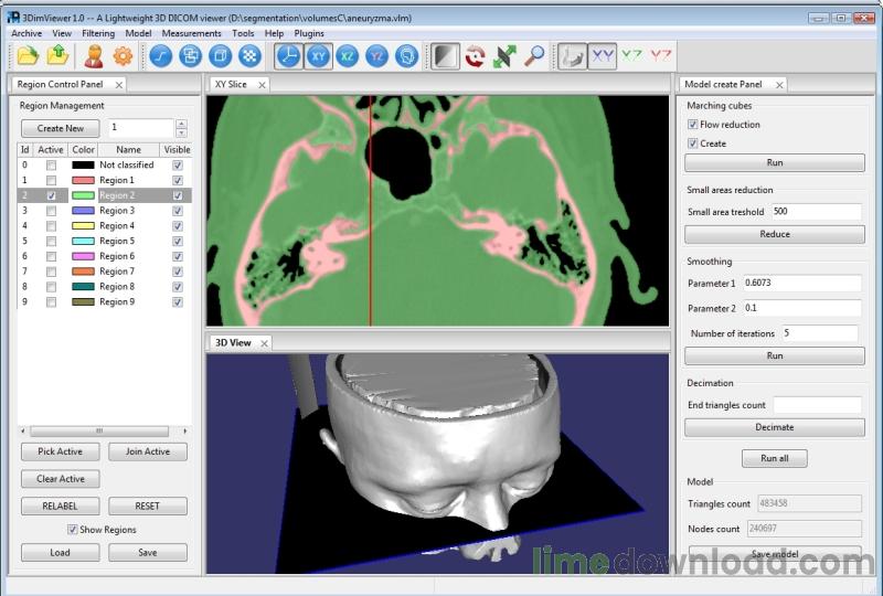 Segmentation Plugins